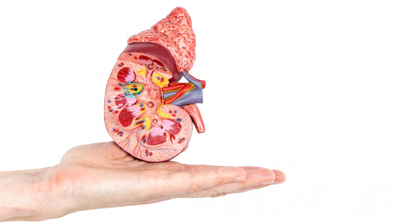 Why This Late-Stage Kidney Cancer Study Could Be Huge