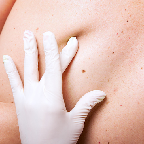 Sienna Biopharma Closes In on IPO