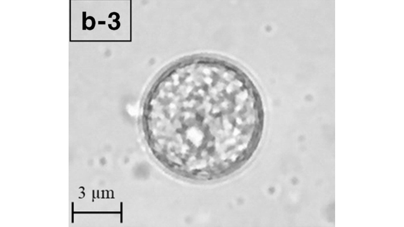 Balamuthia mandrillaris (cyst) by Yamanouchi