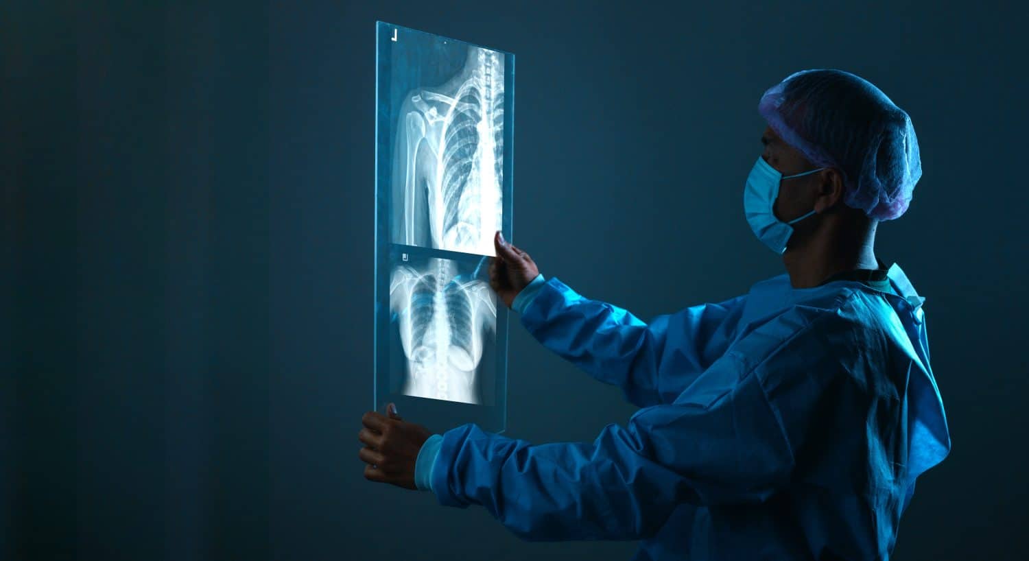 radiology doctor examining at chest x ray film of patient at hospital room.