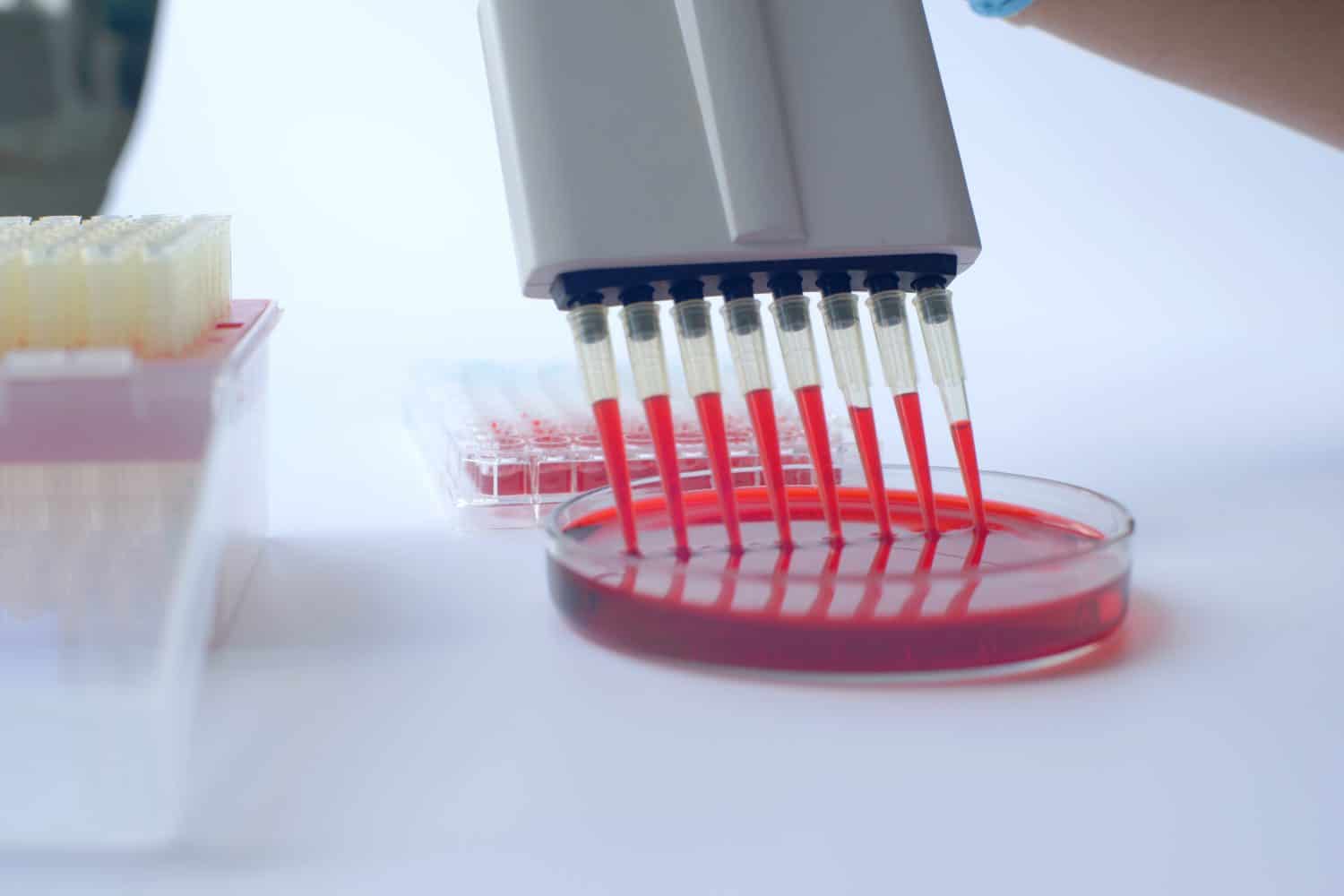 Scientist working with multichannel pipette.Blood test labboratory