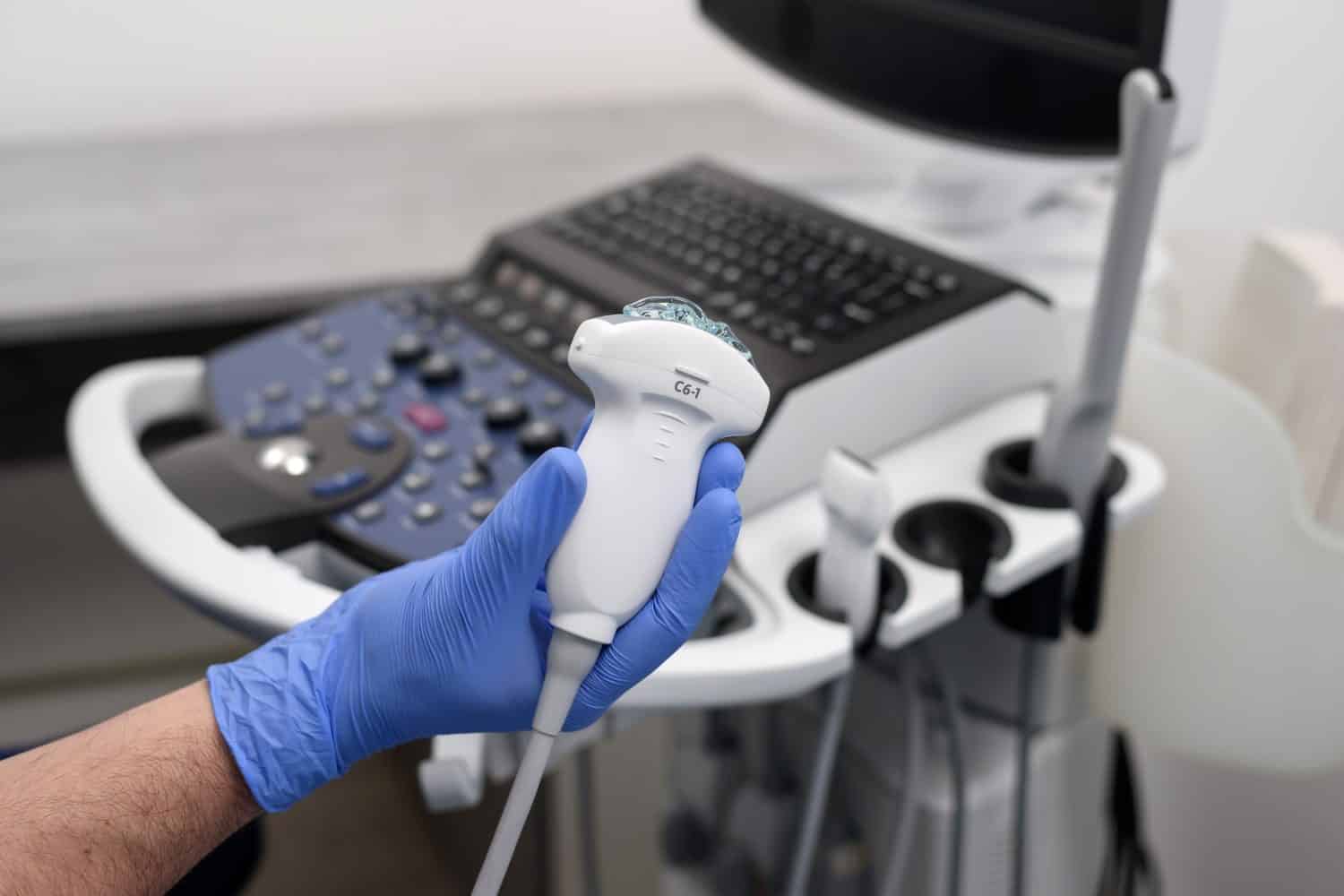 Probe for ultrasound diagnostics close-up. The doctor holds in his hands a transducer with a gel for ultrasound diagnostics of internal organs. Modern ultrasonic machine. Elastography and sonography.